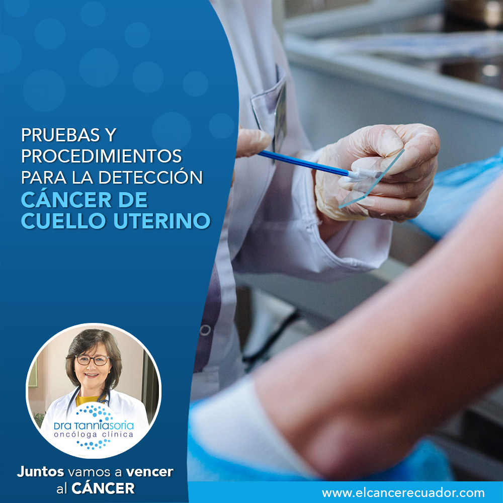 Pruebas y procedimientos para la detección del cáncer de cuello uterino